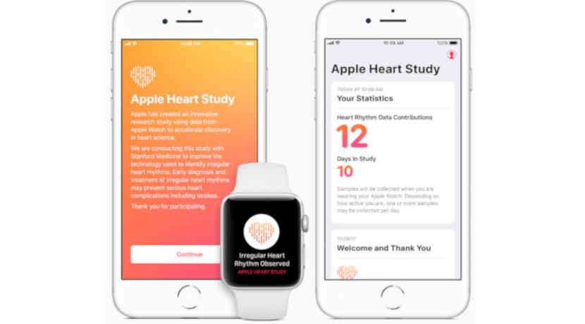 Stanford Studie: Apple Watch findet 2.000 Herzkranke